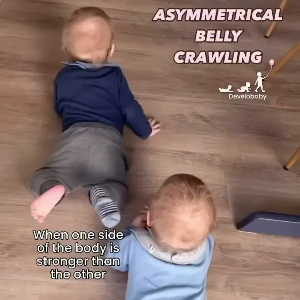 Many babies with asymmetrical development also start to belly crawl asymmetrically, using one leg to push and the oppos…