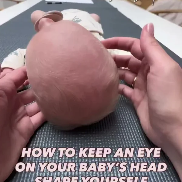 It can save you months of effort and training if you start keeping an eye on your baby’s head shape from the beginning.…