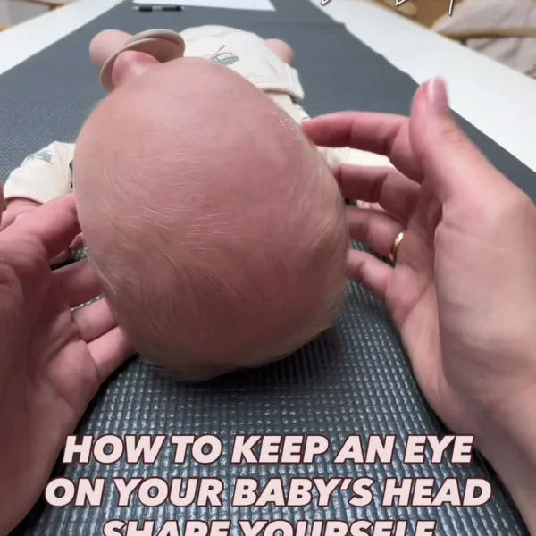 It can save you months of effort and training if you start keeping an eye on your baby’s head shape from the beginning.…
